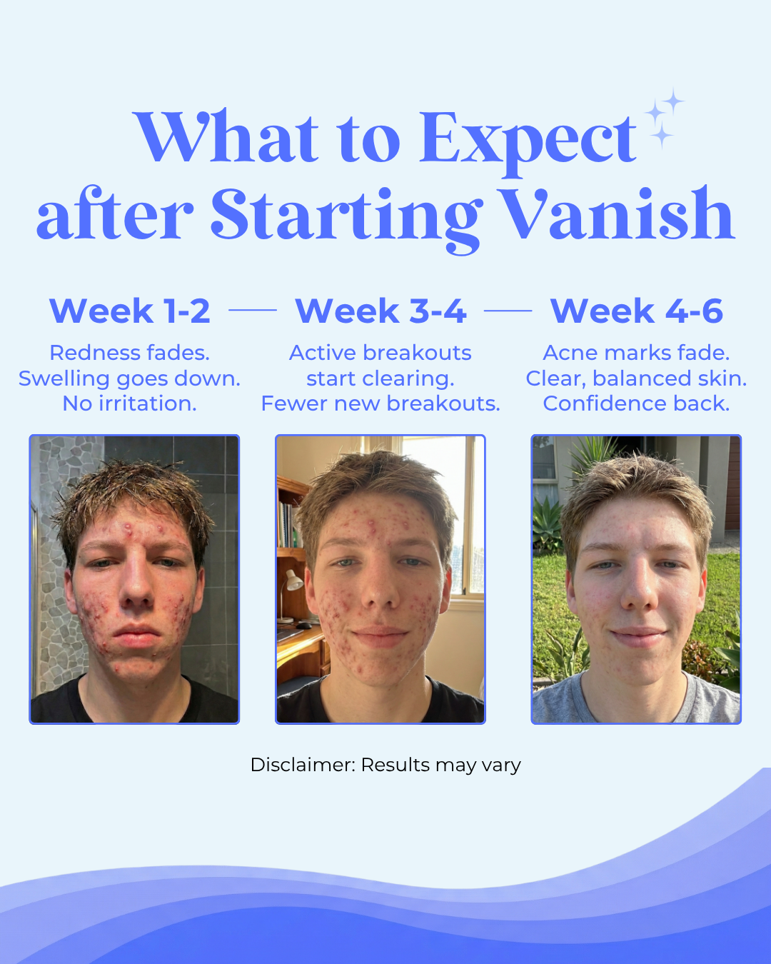 Teen Acne Clearing & Skin Healing Regimen