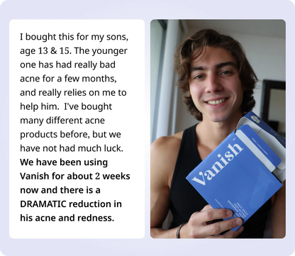 Clear Acne, Heal Skin & Prevent Acne Scars