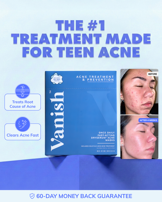 DrySerum™ Teen Acne Kit