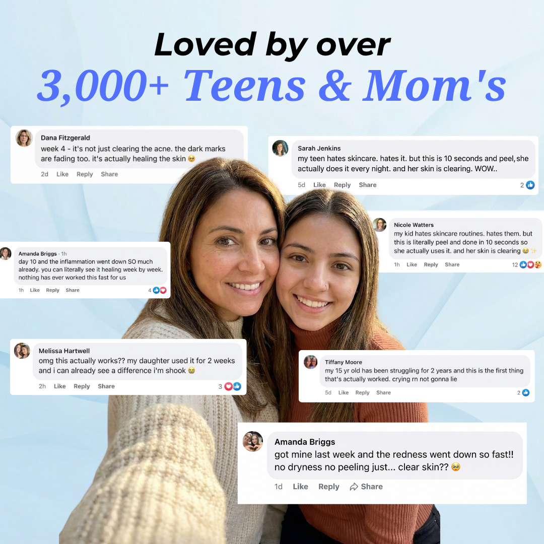 Facebook reviews from 3,000+ moms and teens praising Vanish DrySerum™ for clearing acne fast without dryness or irritation
