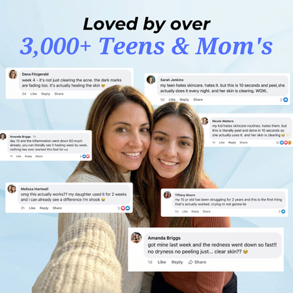 The Acne Vanishing System For Teens